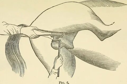 Andrey va Irina Artemyeva jinsiy aloqada