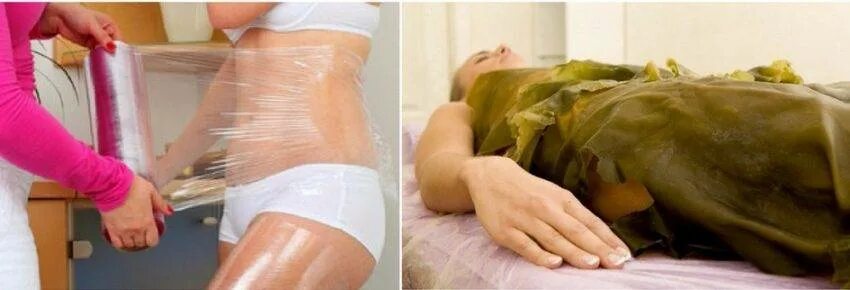 Обертывание плоский живот. Обертывание для похудения до и после. Эффект после обертывания. Обертывания пищевой пленкой от целлюлита. Обёртывание для похудения на ночь.