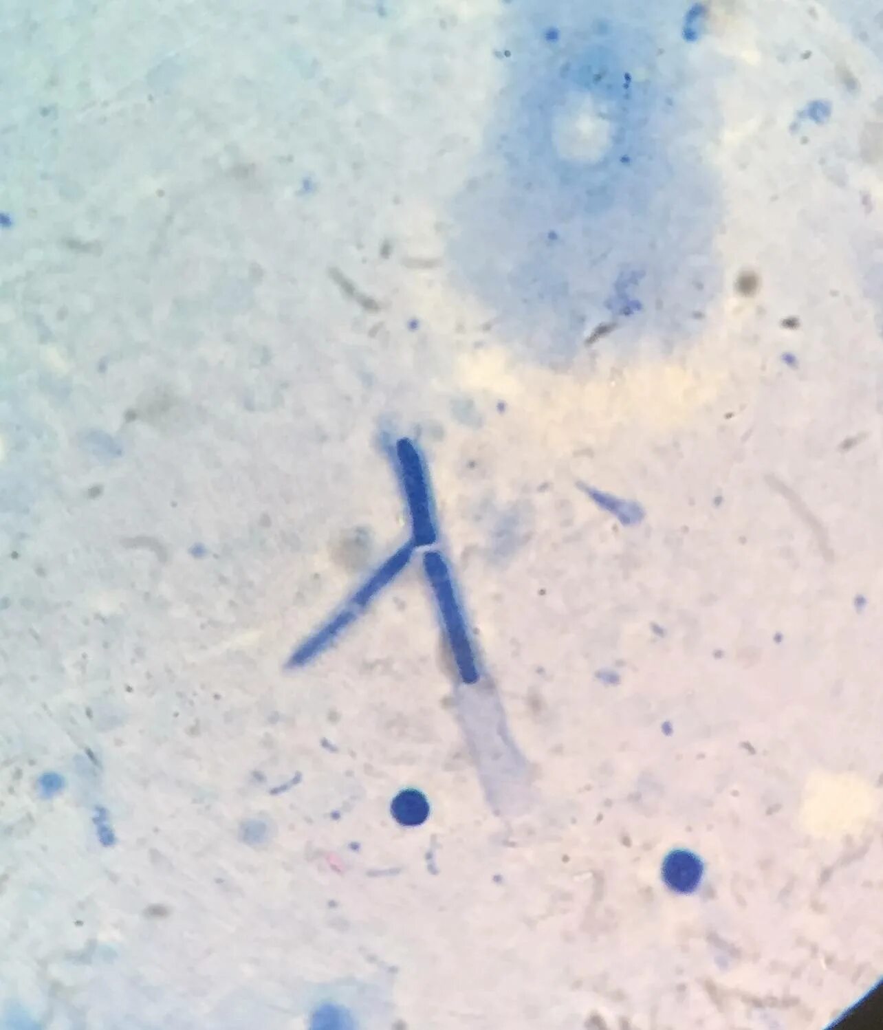 Грибы кандида микроскопия. Грибы Candida псевдомицелий. Микроскопия кандиды псевдомицелий. Кандида в мазке микроскопия. Мицелий грибов у женщин