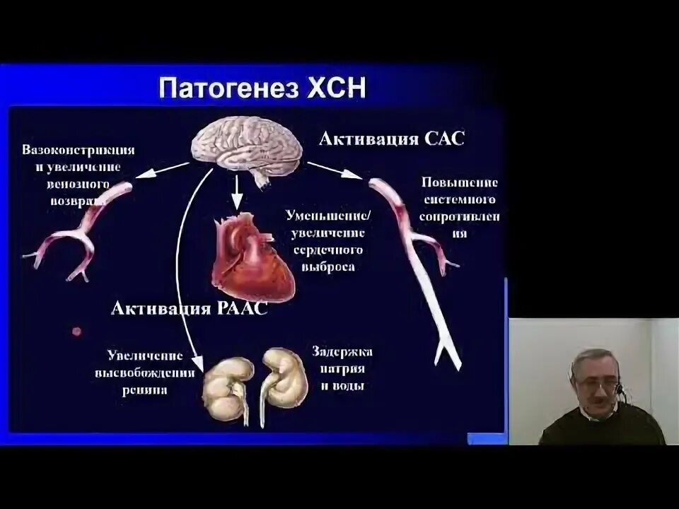 ХСН Факультетская терапия. Хроническая сердечная недостаточность Факультетская терапия. ХСН Факультетская терапия лекции. ХСН поликлиническая терапия лекция. Хроническая сердечная недостаточность 2023