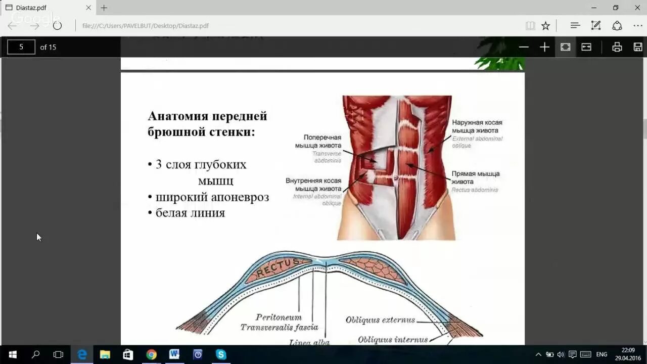 Диастаз код по мкб. Узи диастаза прямых мышц протокол. диастаз прямых мышц живота на узи протокол. диастаз прямой мышцы живота на узи. узи прямых мышц живота.