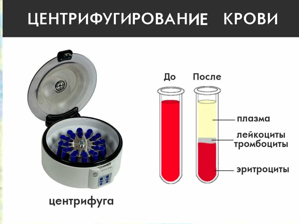 Центрифугирование метод исследования клеток. Кровь после центрифугирования. слои крови после центрифугирования. плазма после центрифугирования. методы изучения клетки центрифугирование.
