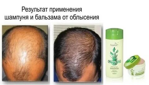 Лучшее домашнее средство от выпадения волос