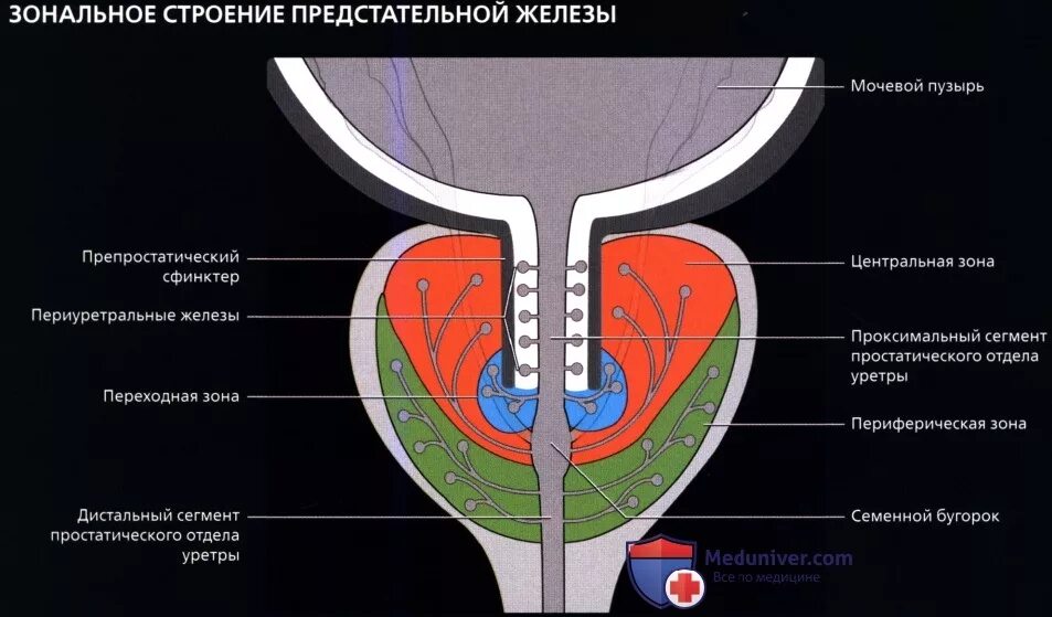 Капсула предстательной железы. Зональная анатомия предстательной железы УЗИ. Зональная анатомия предстательной железы по MCNEAL. Семенной холмик предстательной железы. Парауретральные железы анатомия.