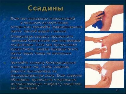 Первые ссадины