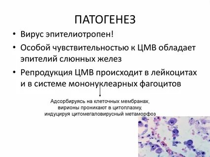 Вг инфекция