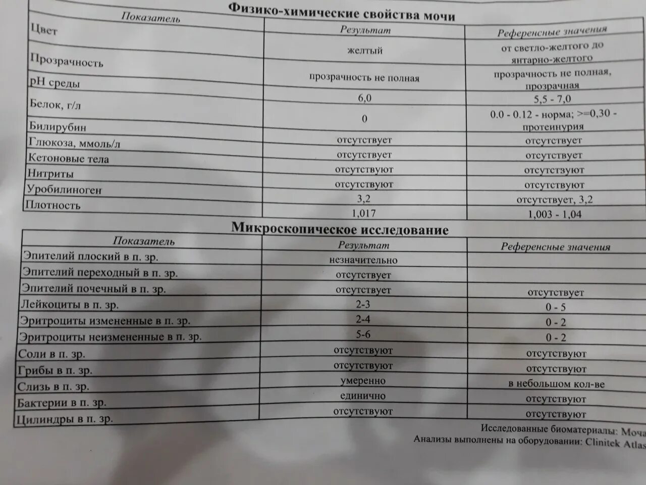 Норма слизи в ОАМ. Слизь показатель мочи. Норма слизи в моче у женщин. Микроскопическое исследование мочи бактерии.