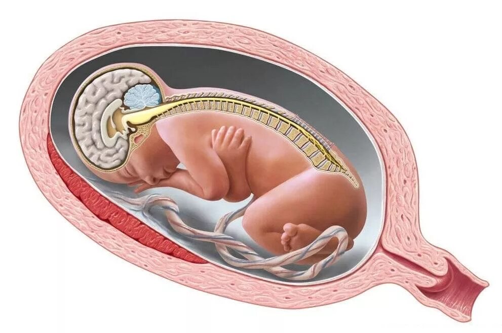 Внутриутробные аномалии развития. Пороки развития нервной трубки. Нервная трубка эмбриона. Пороки развития эмбриона.