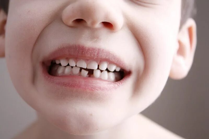 4 года зубы выпадают. Маленькие зубы у ребенка.