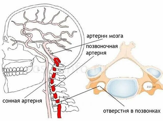 Улучшение кровообращения головного при шейном. Синдром Барре-Льеу (шейная мигрень). Синдром Барре Льеу позвоночной артерии. Шейный отдел позвоночника позвоночная артерия. Синдром позвоночной артерии анатомия.