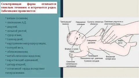Адреногенитальный синдром у новорожденного