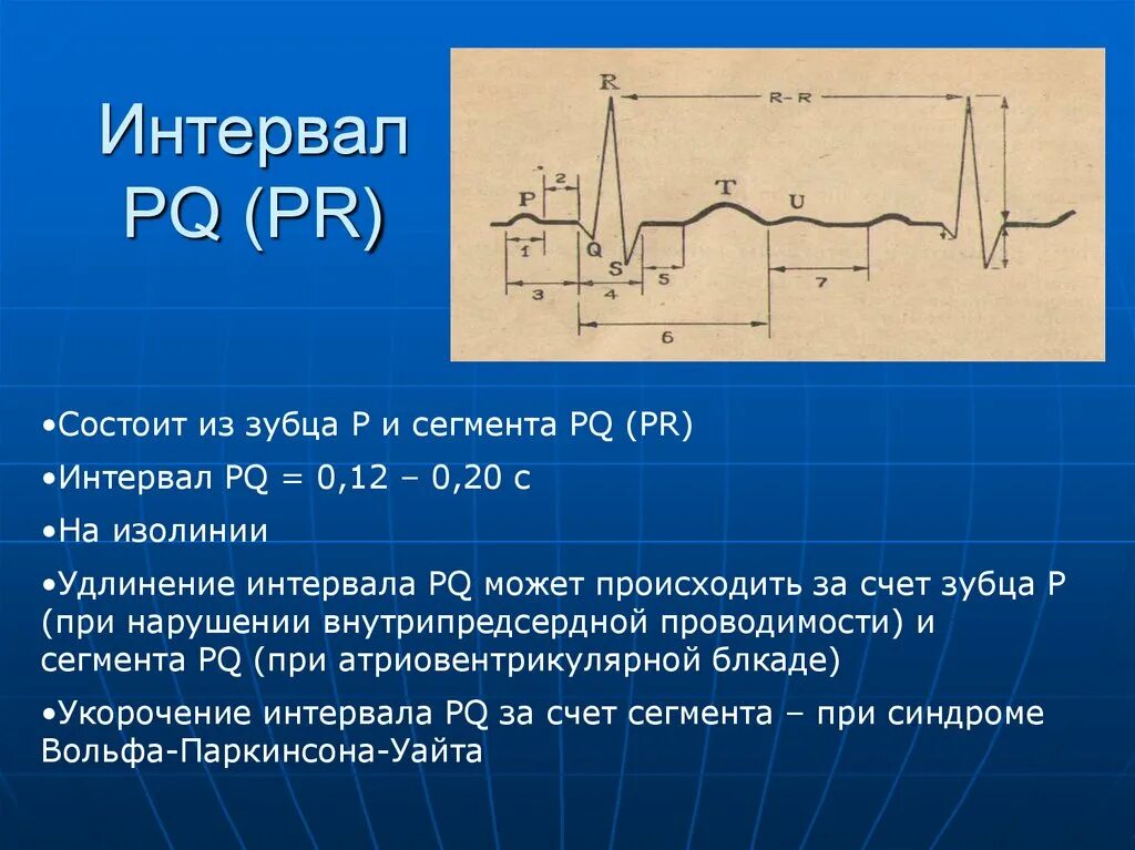 Увеличение интервала pq