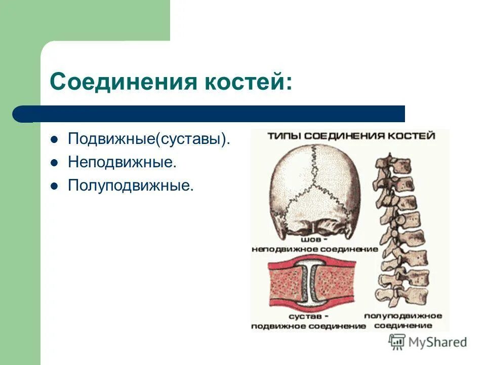 Как называется неподвижное соединение костей. Неподвижные полуподвижные и подвижные соединения костей. соединения костей неподвижные полуподвижные подвижные суставы. типы соединения костей полуподвижные. полуподвижные соединения.