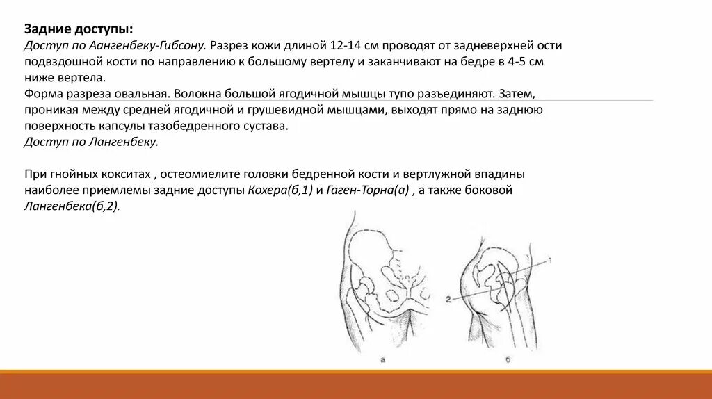 Артротомия плечевого сустава. Артротомия тазобедренного сустава. Артротомия тазобедренного сустава доступы. Артротомия локтевого сустава.