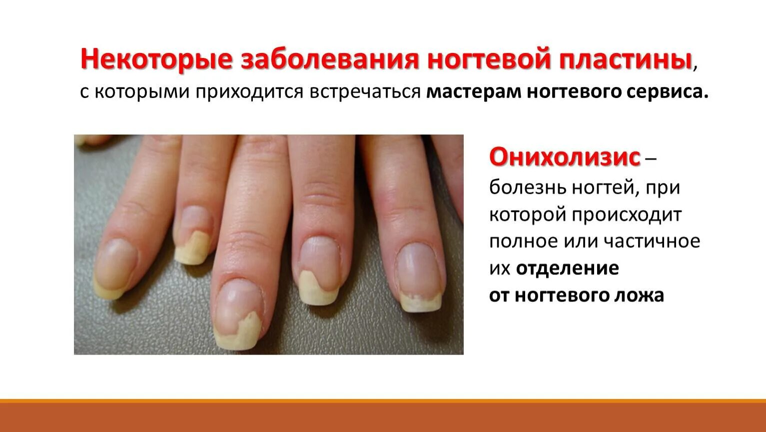 Строение ногтевого матрикса. Заболевания по ногтям рук. Поперечная исчерченность ногтей. Анатомическое строение ногтевой пластины. Строение ногтя анатомия.