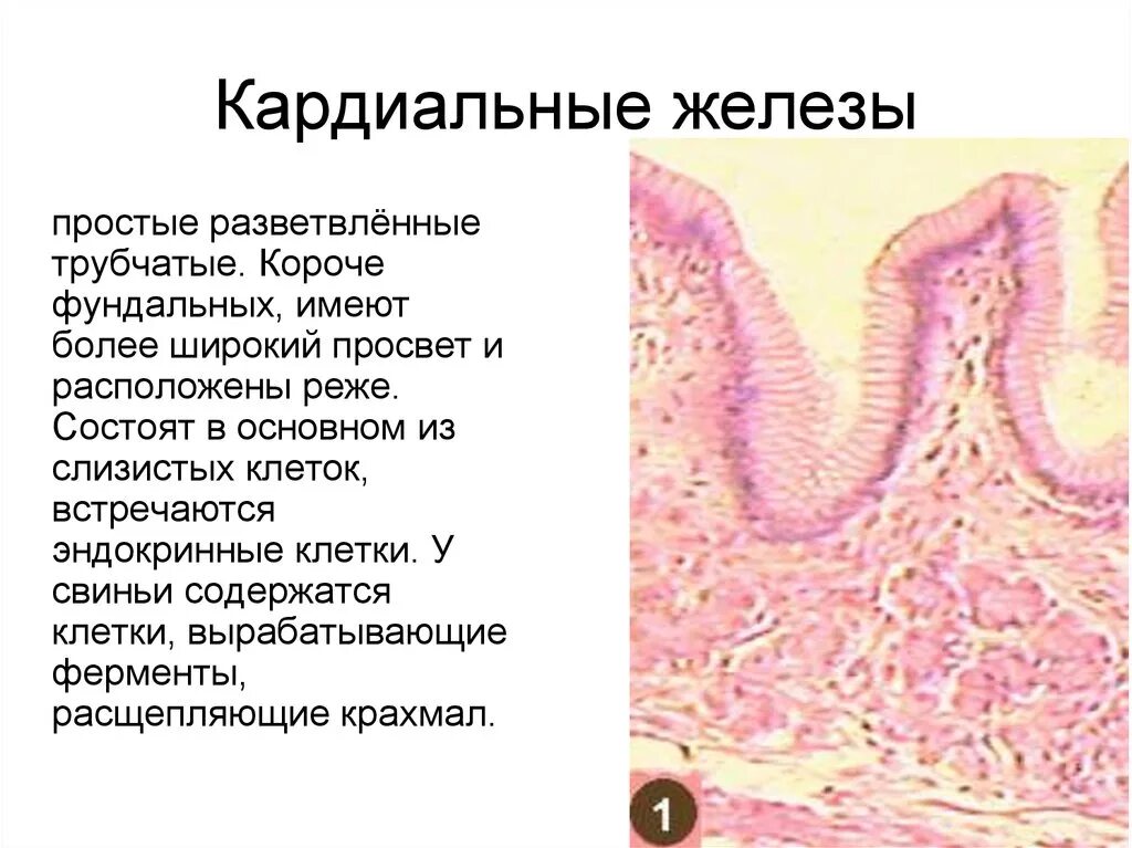 В пищеводе железы расположены в. Кардиальные и пилорические железы. Кардиальные железы желудка строение. Фундальные железы гистология. Простая трубчатая разветвленная железа пилорическая железа.