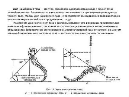 Состояние таза