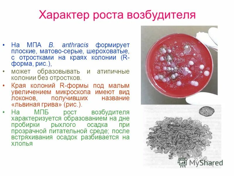 Возбудитель сибирской язвы на МПА. Сибирская язва колонии на МПА. Возбудитель сибирской язвы на питательной среде. Сибирская язва характер колоний.