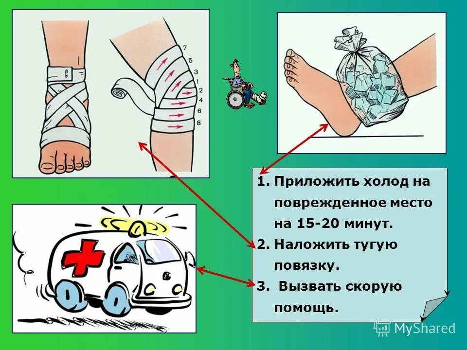 первая помощь при ушибах и вывихах. месту ушиба приложить холод, наложить тугую повязку. первая помощь при ушибах наложить. наложить холод и тугую повязку. первая помощь при растяжении.