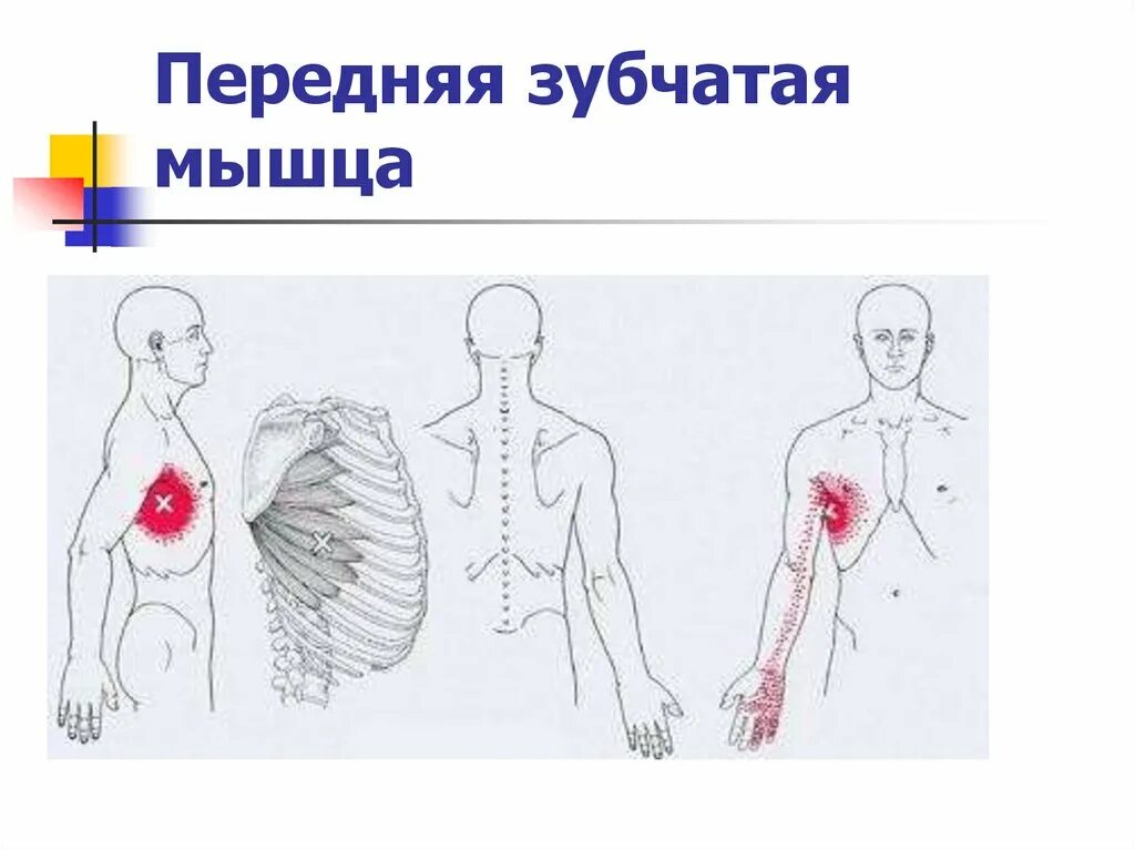 Зубчатый синдром