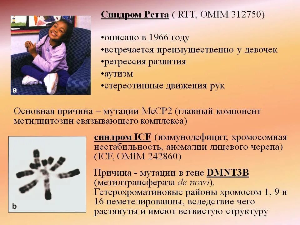Синдром ретта что это такое. Синдром ретта. синдром ретта симптомы. синдром ретта причины. генетическое заболевание ретта.