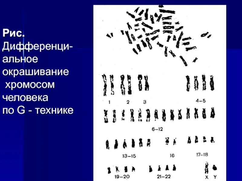 Изменение окраски хромосом. Дифференциальная окраска хромосом. Методы дифференциальной окраски хромосом. Методы дифференциального окрашивания хромосом. Хромосомы человека.