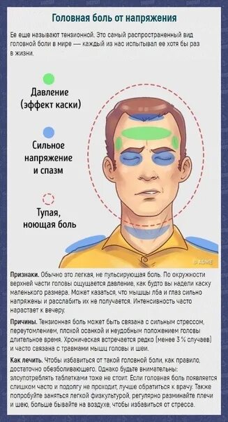 Болит левый висок головы у женщин. Головная боль в висках причины. Пульсирующая боль в левом Виске. Боль в левом Виске головы. Вечные боли в левом Виске.