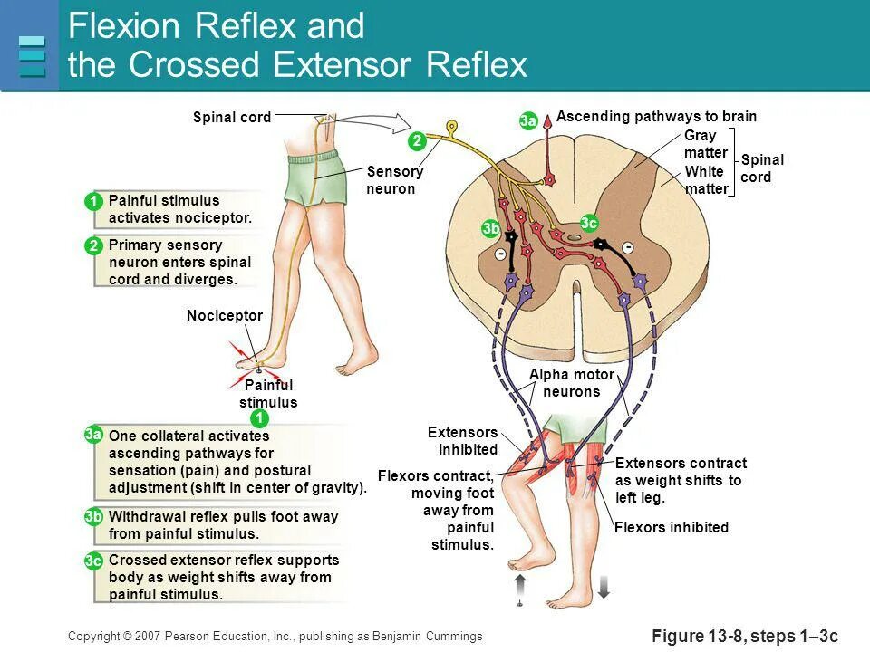 Нижний рефлекс Ландау. Crossed extensor Reflex. T-рефлекса. Reflex time.