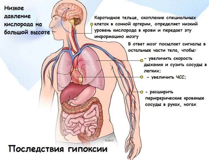 Причины гипоксии мозга. Гипоксия. Безкислороднте голодание. Признаки гипоксии. Гипоксия кислородное голодание.