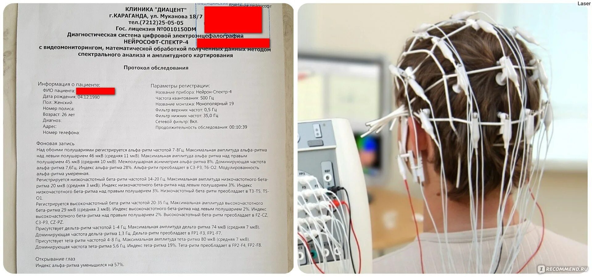 Сколько делается ээг ребенку. Кресло для ээг нейрософт. рутинная ээг. ээг прибор для измерения. ээг проведение процедуры.