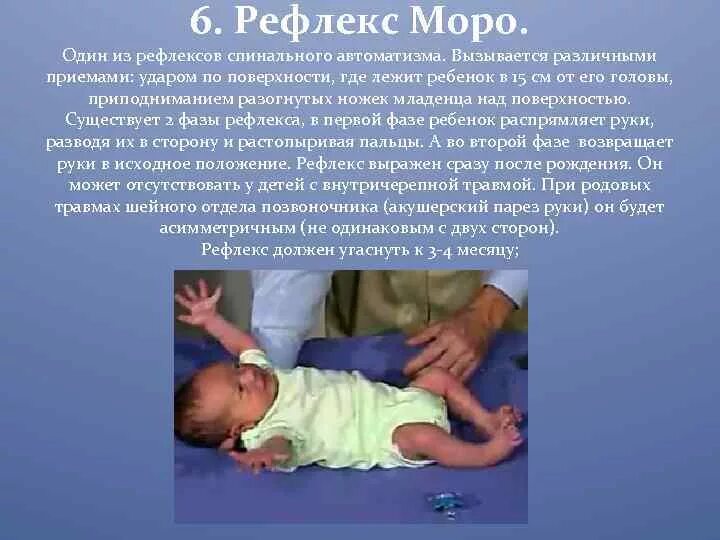 Безусловные рефлексы Моро у ребёнка. Рефлексы Моро у новорожденного. Рефлексы новорожденного Бабинского Моро. Охарактеризуйте рефлексы новорожденного.