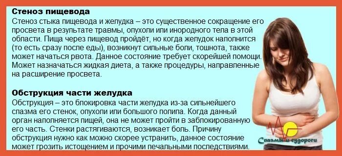 Колики в животе у взрослых лечение. Спазмы в желудке после еды. Спастические боли в желудке. Спазм желудка после еды.