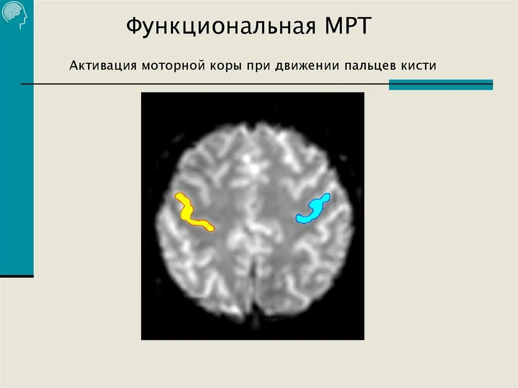 Ран мозга бехтеревой. Функциональная мрт. Функциональный магнитный резонанс. Функциональная магнитно-резонансная визуализация.