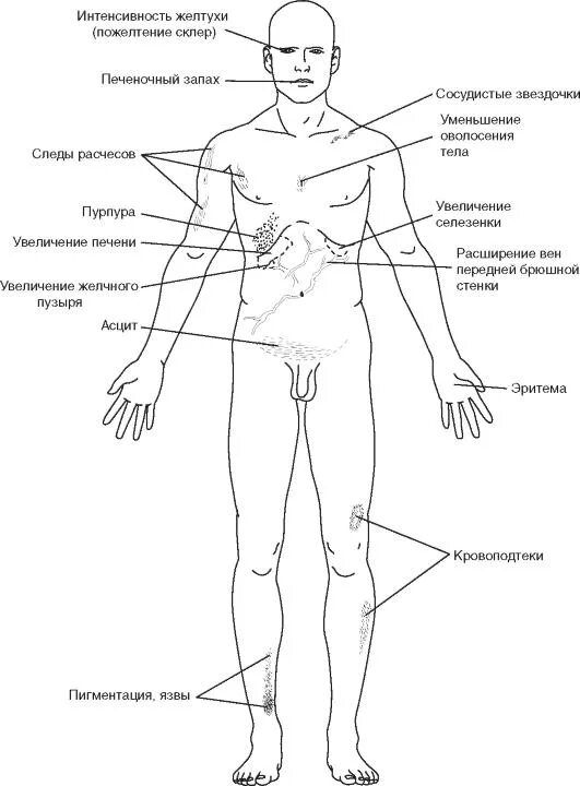 Проекция желчного пузыря на переднюю брюшную стенку. Проекция желчного пузыря на переднюю брюшную стенку