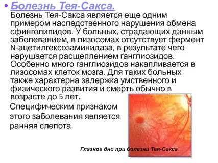 Болезнь тей