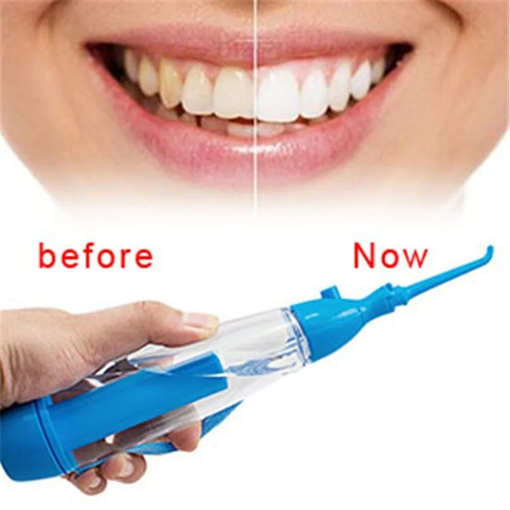 Ирригатор для зубов. Ирригатор отбеливает зубы. Ирригатор для зубов. Отбеливание зубов ирригатором. Зубы до и после ирригатора.