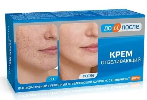 Крем до и после отзывы До и После: Отбеливающий крем (100 мл) от 360 руб. с доставкой по Москве и Росси