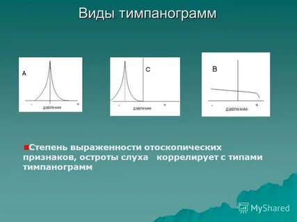 Тимпанограмма