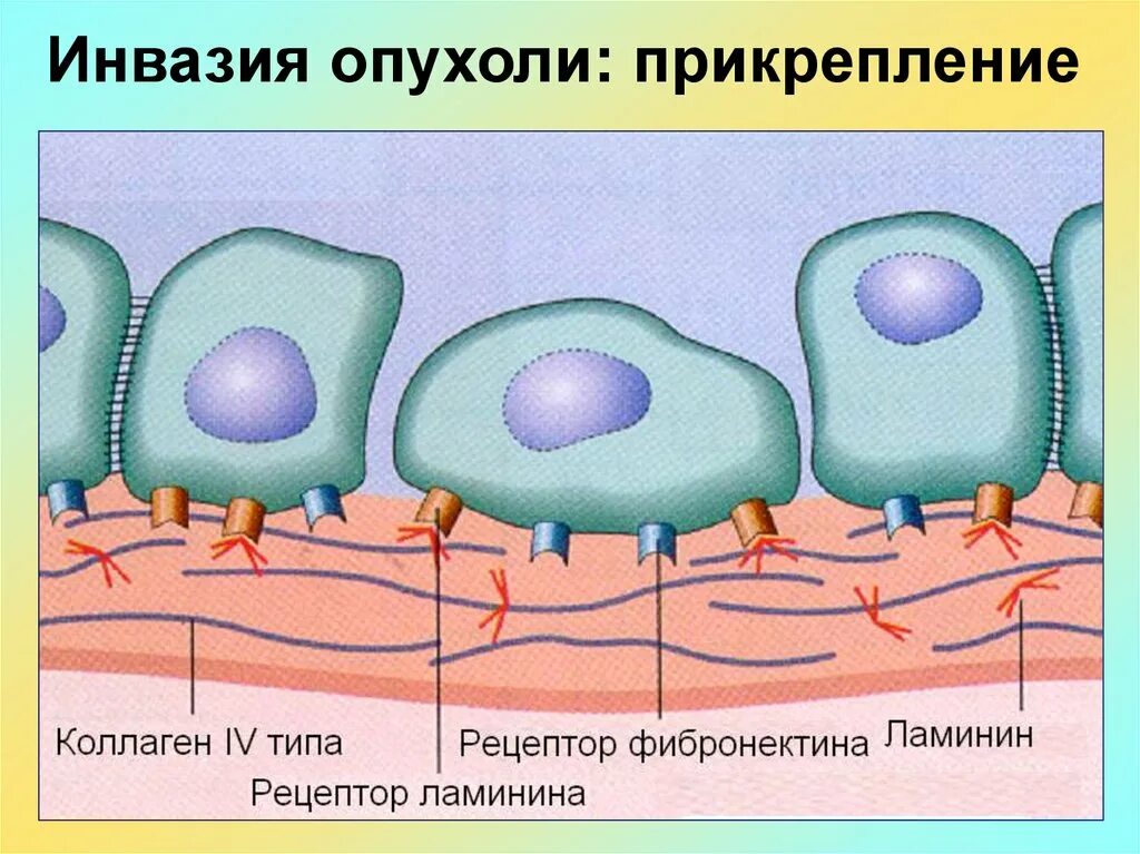 Опухоли патофизиология. Инвазивный рост опухоли. Патогенез злокачественных опухолей патофизиология. Степень инвазии