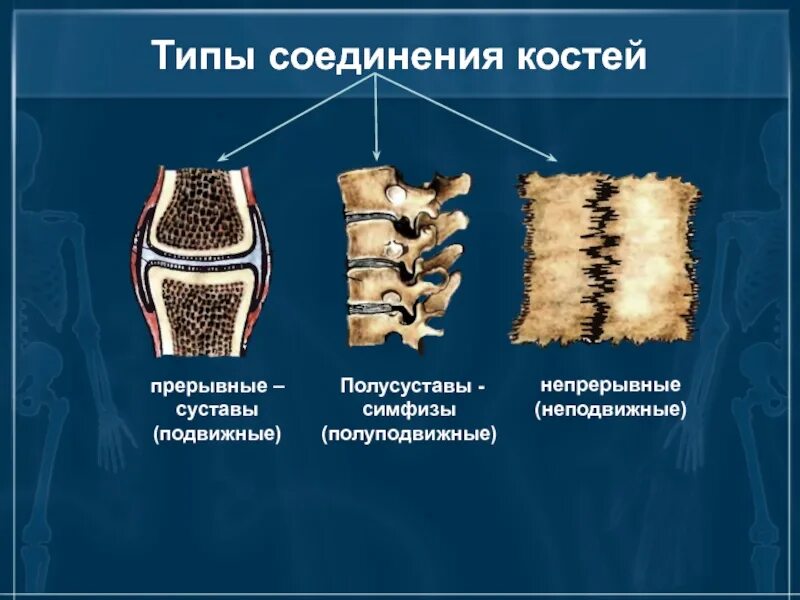 Прерывное соединение кости. Соединение костей непрерывные прерывные полусуставы. Соединение костей неподвижные полуподвижные. Полуподвижное соединение костей симфиз. Симфиз непрерывный соединение костей.