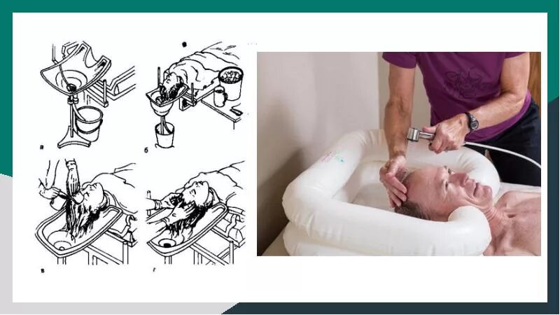 Мытье пациента. Уход за волосами тяжелобольного пациента. Мытье головы тяжелобольного. Мытье волос тяжелобольному пациенту. Мытье тяжелобольных пациентов