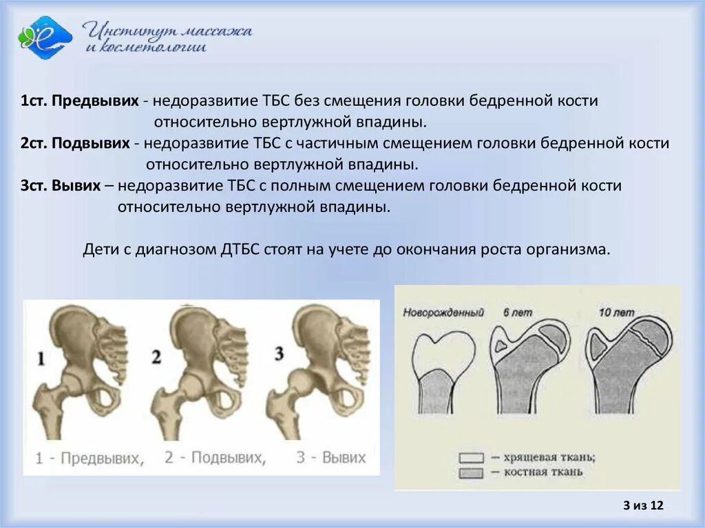 Дисплазия сустава у новорожденного лечение