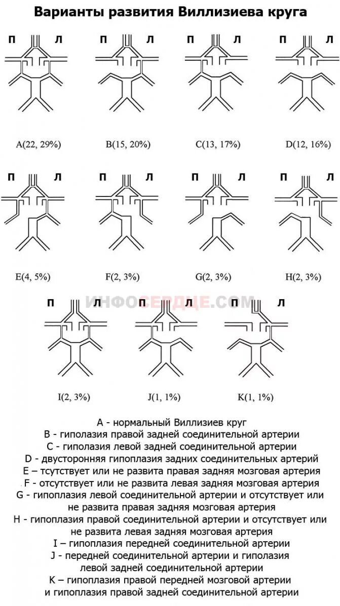 Правая задняя трифуркация. Основные сосуды артериального Виллизиева круга. Варианты строения Виллизиева круга схема. Варианты развития передней мозговой артерии. Варианты строения Виллизиева круга мрт.