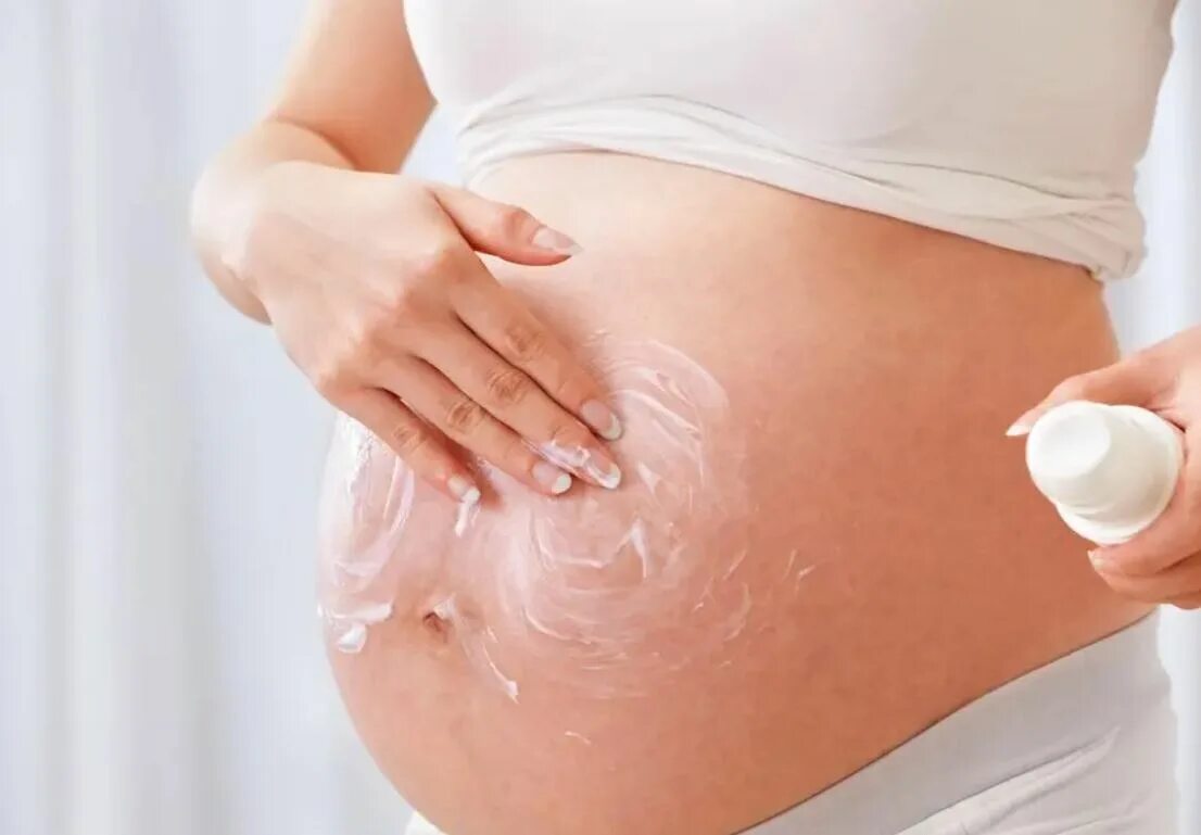 У беременной болит кожа на животе. Растяжки во время беременности.