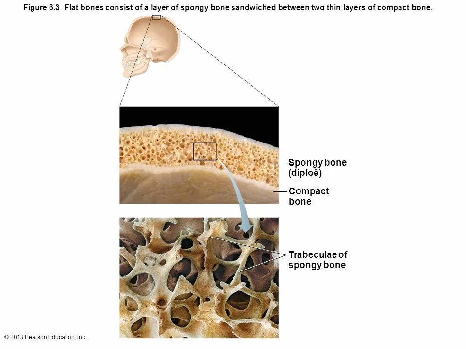The bones consist of