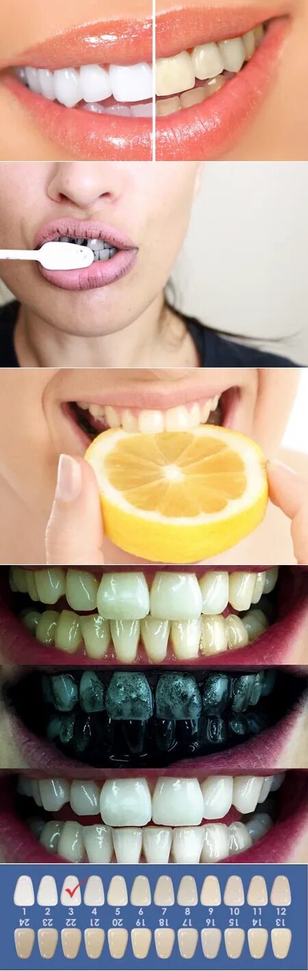 Отбеливание зубов. Отбелевание Зублов в домаш. Как отбелить зубы в домашних условиях. Отбеливание желтых зубов.