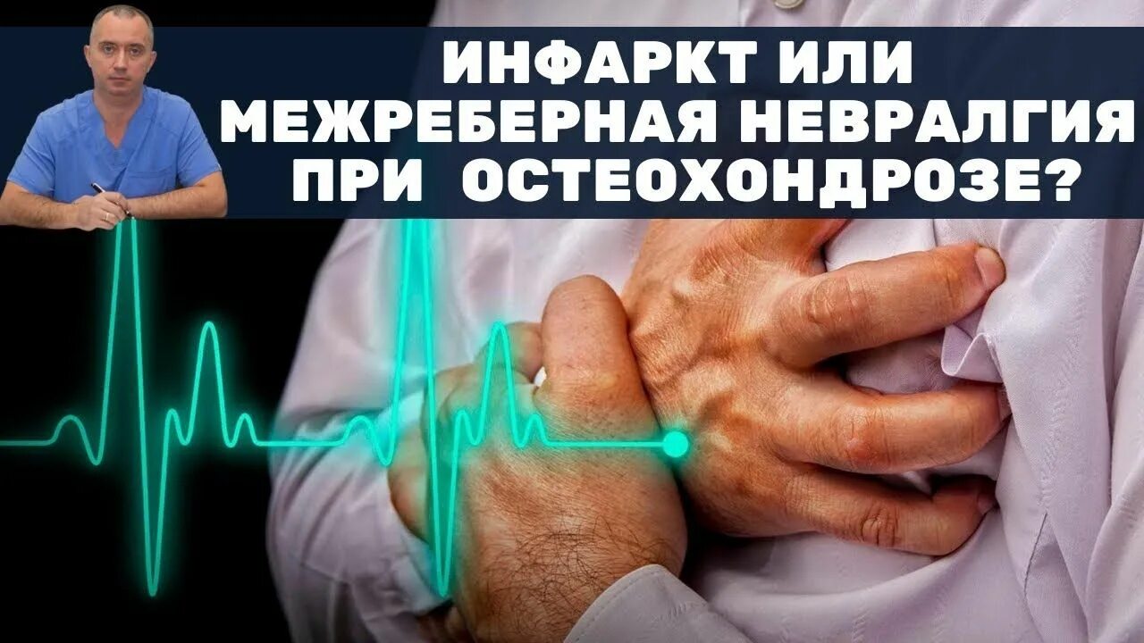 Инфаркт или невралгия. Межреберная невралгия Шишонин. Межреберная невралгия и инфаркт. Невралгия или сердце.