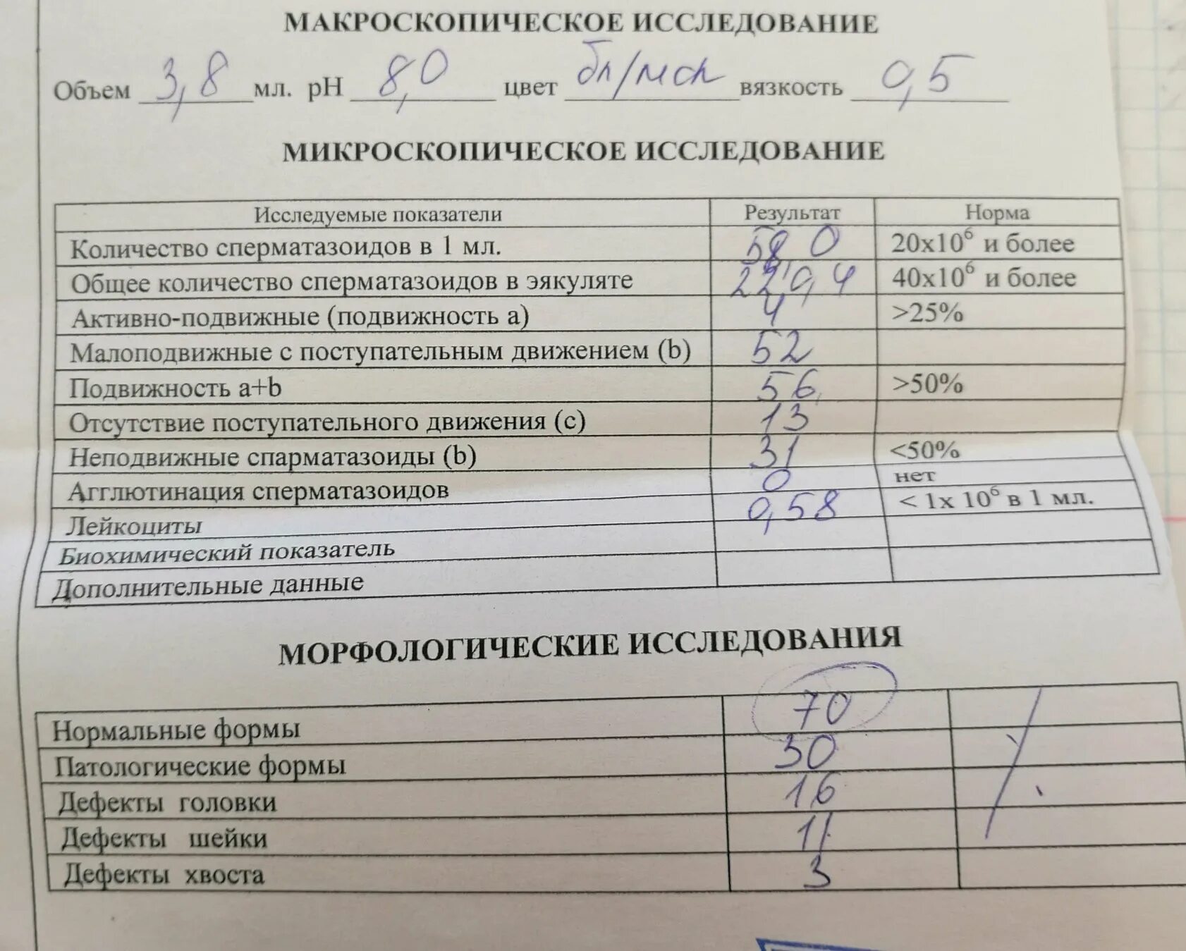 Подготовка к спермограмме