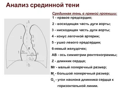 Легочная дуга