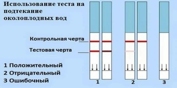 Тест на подтекание околоплодных вод. Положительный результат тест прокладки на подтекание околоплодных. Положительный тест на подтекание вод. Положительный тест на околоплодные воды.